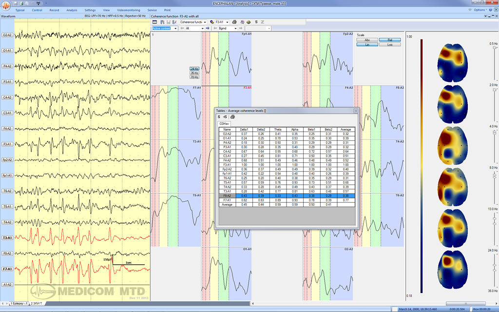 EEG spectral analysis of signals