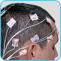 Adhesive electrodes