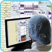 "Encephalan-NM" Software for Neuromonitoring in ICU