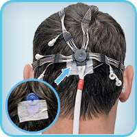 Adhesive cup EEG electrodes