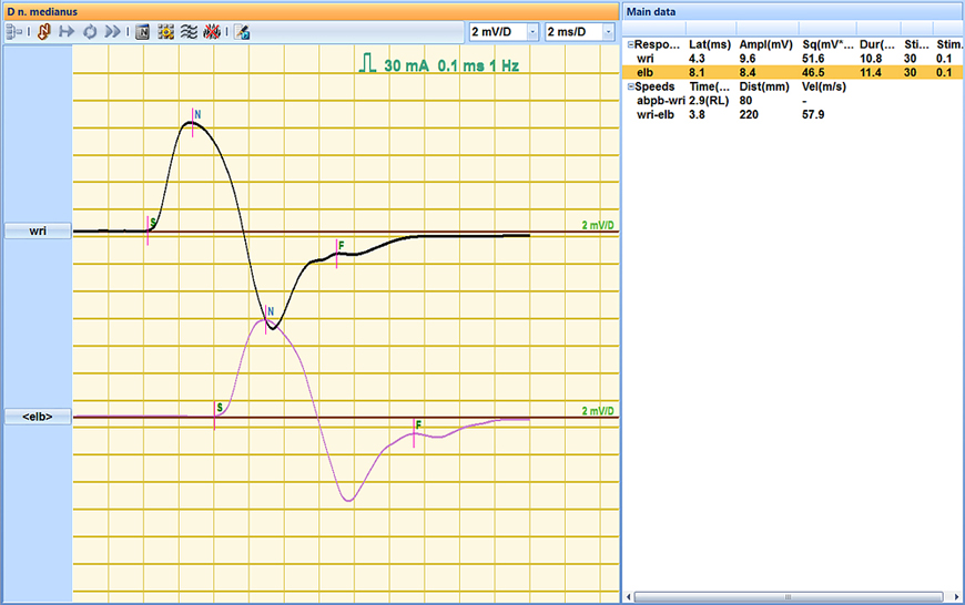 Motor conduction velocity