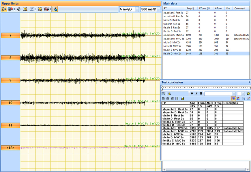 One-channel surface EMG