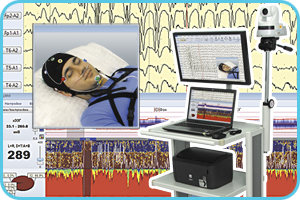 Videomonitoring kit for EEG-video