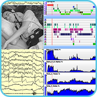 Somnologische Untersuchungen Enzefalan-PSG