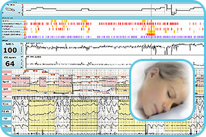 Software for sleep disorders analysis
