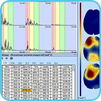 Спектральный анализ ЭЭГ-сигналов