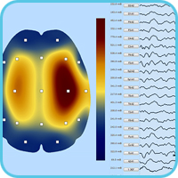 Измерение амплитудных значений ЭЭГ и топографическое 2D картирование размаха амплитуд 
