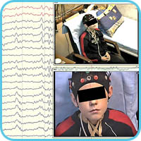 EEG monitoring and video from 2 cameras