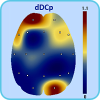 Пространственное распределение максимального смещения сверхмедленных потенциалов dDCp