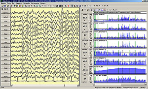 Combined signal analysis