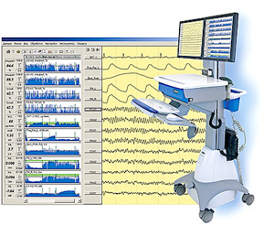 Telemetry EEG-Studies