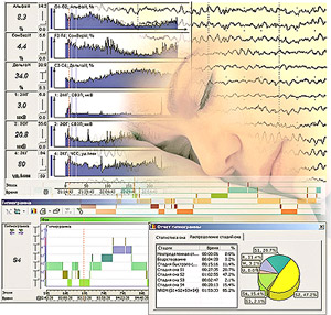Polysomnographic studies