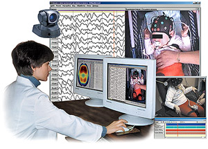 Long-term EEG-videomonitoring (Stationary set)