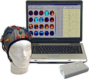 Telemetry EEG-Studies