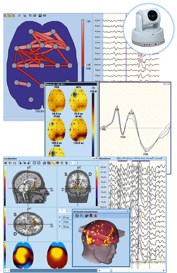 Medicom MTD: Electroencephalograph-analyzer EEGA-21/26