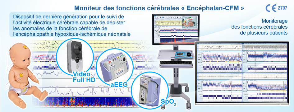 Moniteur des fonctions cérébrales