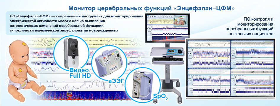 Монитор церебральных функций неонатология